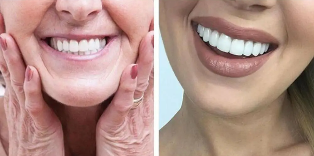 😁 Carillas Dentales Snap-On Smile – ¡Transforma Tu Sonrisa al Instante! 🦷✨ 🎁 ¡PROMO ESPECIAL! Compra 1 y Llévate 2🔥