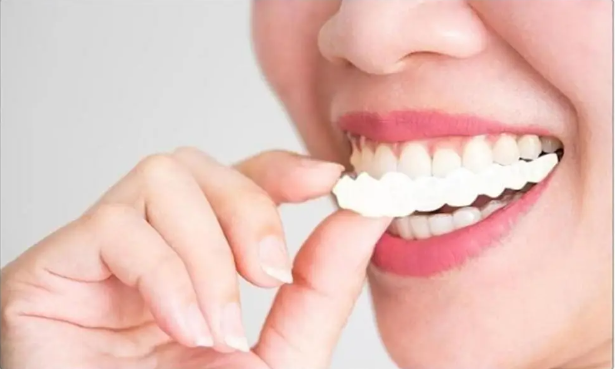 😁 Carillas Dentales Snap-On Smile – ¡Transforma Tu Sonrisa al Instante! 🦷✨ 🎁 ¡PROMO ESPECIAL! Compra 1 y Llévate 2🔥